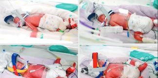 Naturally-conceived identical quadruplet babies born recently are all in the hospital's nursery, in an incubator, wearing a breathing device. METRO NORTH HEALTH