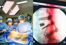 The Western Visayas Medical Center’s Neurosurgery Spine team performs the region’s first combined eXtreme Anterior Lumbar Interbody Fusion (XALIF) and Anterior-to-Psoas (ATP) spine surgery on a 63-year-old patient suffering from degenerative spine disease on September 19, 2026. The pioneering procedure, led by neurosurgeon Dr. Derek Ben T. Jabines, marks a major advancement in specialized spinal care, bringing complex surgical treatment closer to patients in Western Visayas. PHOTOS COURTESY OF WVMC