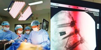 WVMC pioneers advanced spine surgery in Region 6 The Western Visayas Medical Center’s Neurosurgery Spine team performs the region’s first combined eXtreme Anterior Lumbar Interbody Fusion (XALIF) and Anterior-to-Psoas (ATP) spine surgery on a 63-year-old patient suffering from degenerative spine disease on September 19, 2026. The pioneering procedure, led by neurosurgeon Dr. Derek Ben T. Jabines, marks a major advancement in specialized spinal care, bringing complex surgical treatment closer to patients in Western Visayas. PHOTOS COURTESY OF WVMC